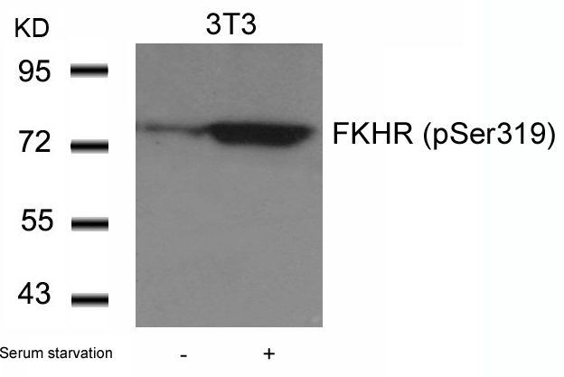 Polyclonal Antibody to FKHR (Phospho-Ser319)