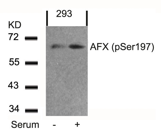 Polyclonal Antibody to AFX (Phospho-Ser197)