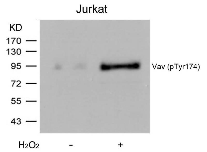 Polyclonal Antibody to Vav (Phospho-Tyr174)