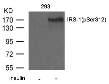 Polyclonal Antibody to IRS-1(Phospho-Ser312)