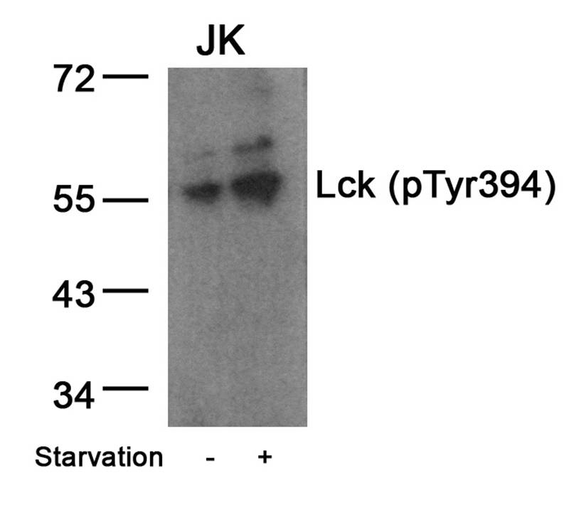 Polyclonal Antibody to Lck (Phospho-Tyr394)