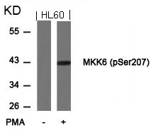 Polyclonal Antibody to MKK6 (Phospho-Ser207)