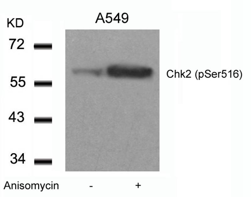 Polyclonal Antibody to Chk2 (Phospho-Ser516)