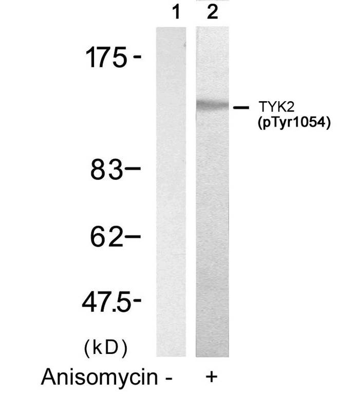 Polyclonal Antibody to TYK2 (Phospho-Tyr1054)