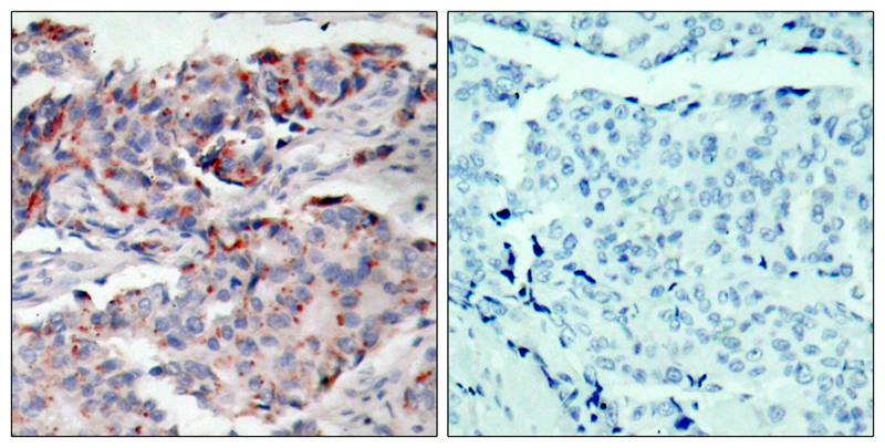 Polyclonal Antibody to JAK2(Phospho-Tyr221)