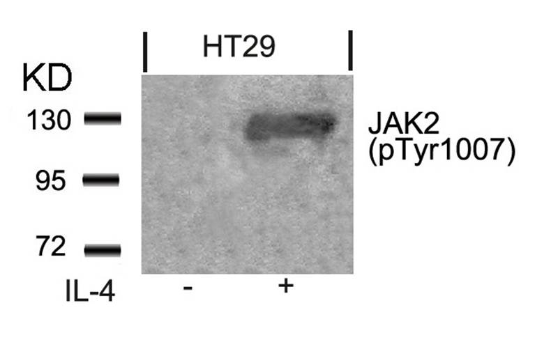 Polyclonal Antibody to JAK2 (Phospho-Tyr1007)