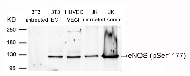 Polyclonal Antibody to eNOS (Phospho-Ser1177)