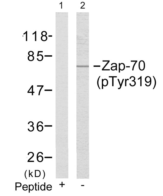 Polyclonal Antibody to Zap-70 (Phospho-Tyr319)