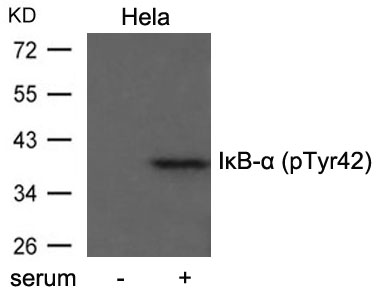 Polyclonal Antibody to IkB- Alpha (Phospho-Tyr42) Antibody