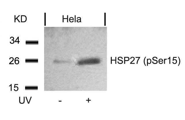 Polyclonal Antibody to HSP27 (Phospho-Ser15)