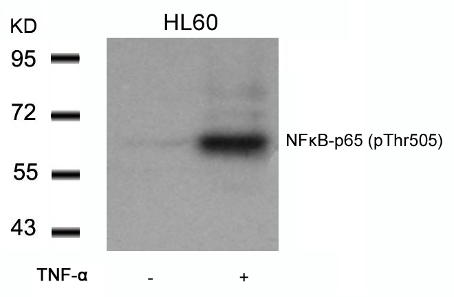 Polyclonal Antibody to NFkB-p65 (Phospho-Thr505)