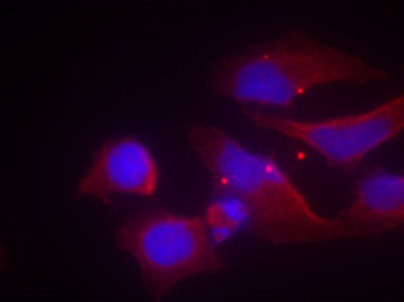 Polyclonal Antibody to NMDAR2B (phospho-Tyr1474)