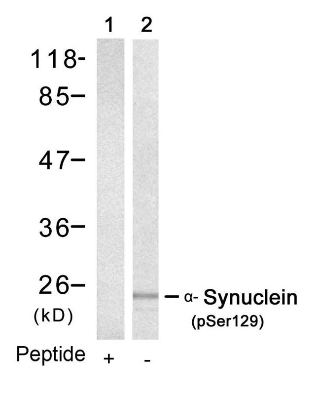 Polyclonal Antibody to  Alpha-Synuclein (Phospho-Ser129)