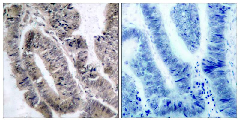 AMPK Alpha1 (Phospho-Ser487) Polyclonal Antibody