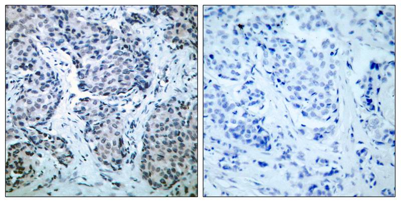 Polyclonal Antibody to SEK1/MKK4 (Phospho-Thr261)