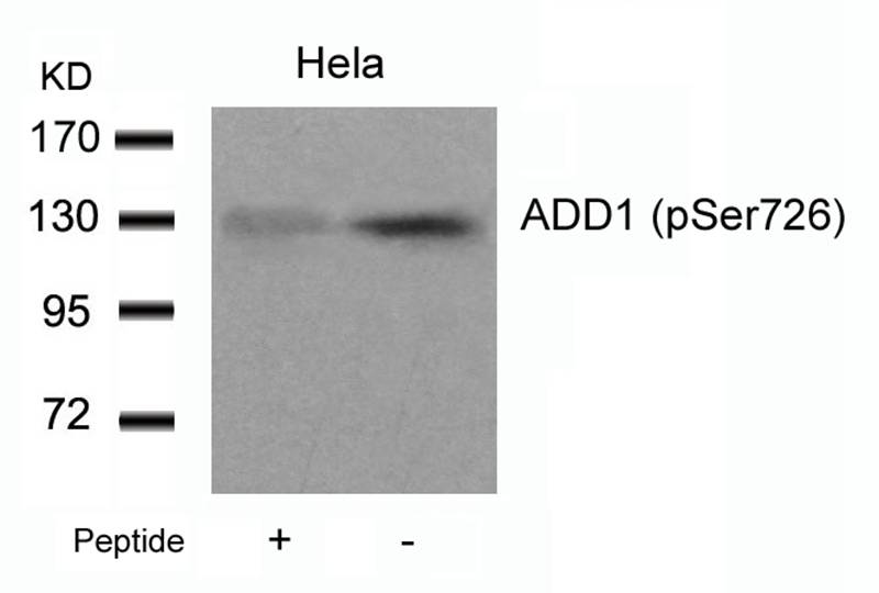 Polyclonal Antibody to ADD1 (Phospho-Ser726)