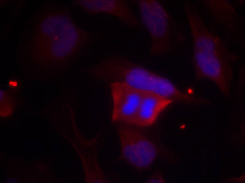 Polyclonal Antibody to DARPP-32 (Phospho-Thr75)