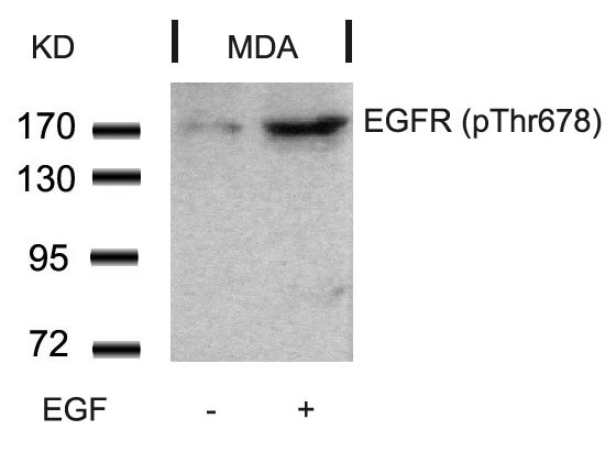 Polyclonal Antibody to EGFR (Phospho-Thr678)