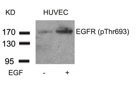 Polyclonal Antibody to EGFR (Phospho-Thr693)