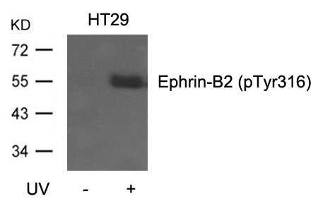 Polyclonal Antibody to Ephrin-B2 (Phospho-Tyr316)