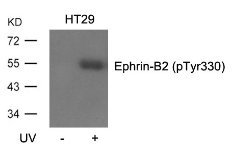 Polyclonal Antibody to Ephrin-B2 (Phospho-Tyr330)