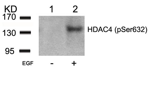 Polyclonal Antibody to HDAC4 (Phospho-Ser632)