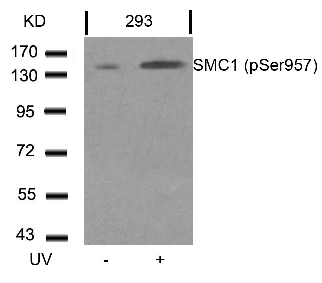 Polyclonal Antibody to SMC1 (Phospho-Ser957)