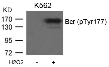 Polyclonal Antibody to Bcr (Phospho-Tyr177)