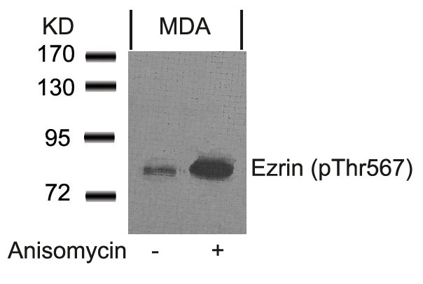 Polyclonal Antibody to Ezrin (Phospho-Thr567)