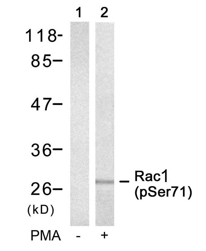 Polyclonal Antibody to Rac1 (Phospho-Ser71)