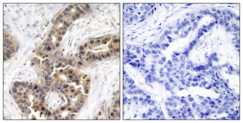 Polyclonal Antibody to p21Cip1 (Phospho-Thr145)