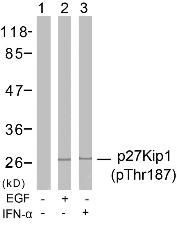 Polyclonal Antibody to p27Kip1 (Phospho-Thr187)