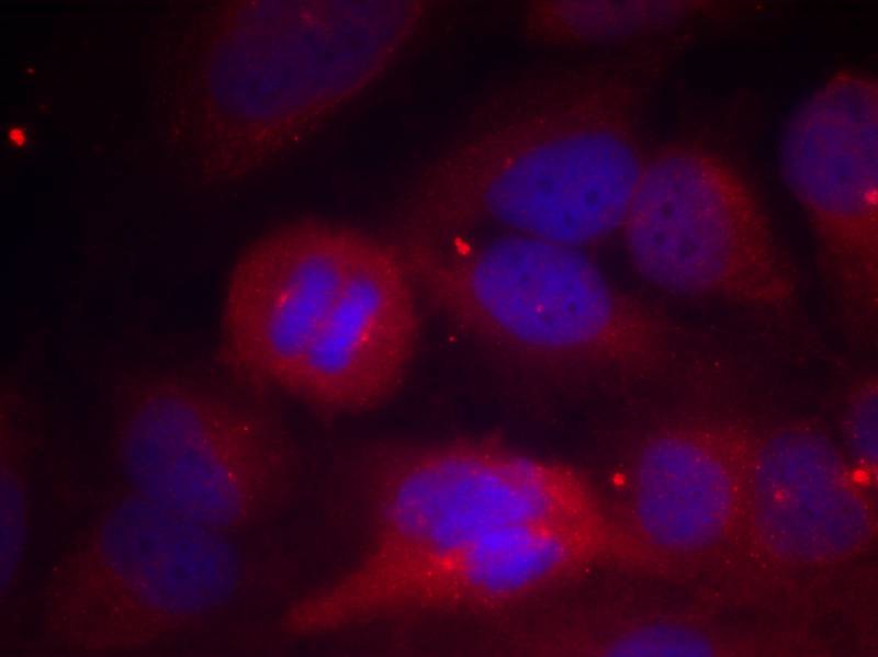 Polyclonal Antibody to Tyrosine Hydroxylase (Phospho-Ser40)