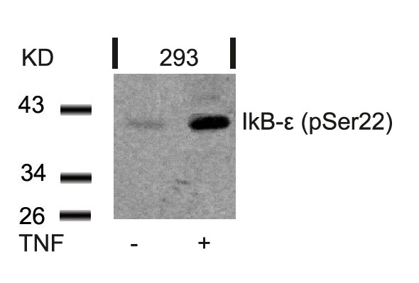 Polyclonal Antibody to IkB-epsilon (Phospho-Ser22)