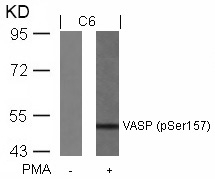 Polyclonal Antibody to VASP (Phospho-Ser157)