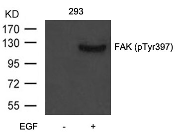 Polyclonal Antibody to FAK (Phospho-Tyr397)