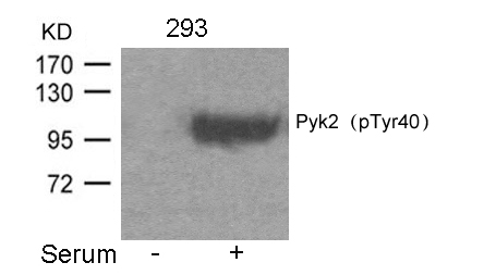 Polyclonal Antibody to Pyk2 (Phospho-Tyr402)