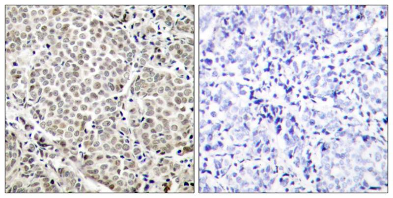 Polyclonal Antibody to NFkB-p65 (Phospho-Ser529)