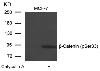 Polyclonal Antibody to beta-Catenin (Phospho-Ser33)