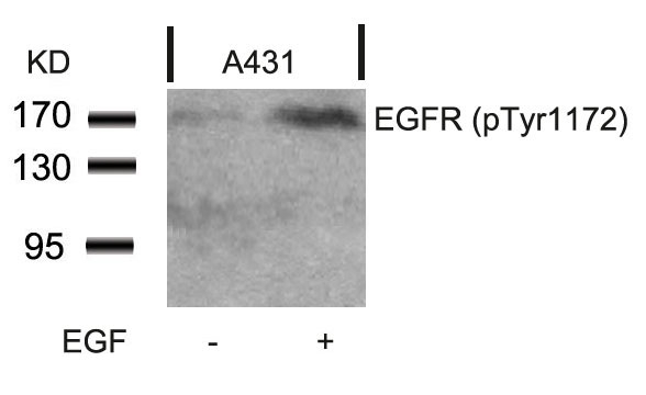 Polyclonal Antibody to EGFR (Phospho-Tyr1172)