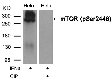 Polyclonal Antibody to mTOR (Phospho-Ser2448)