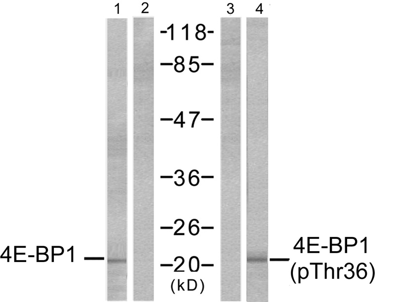 Polyclonal Antibody to 4E-BP1(Phospho-Thr36)