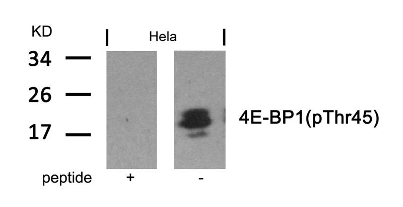 Polyclonal Antibody to 4E-BP1 (Phospho-Thr45)