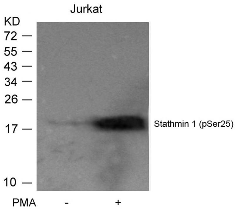 Polyclonal Antibody to Stathmin 1 (Phospho-Ser25)