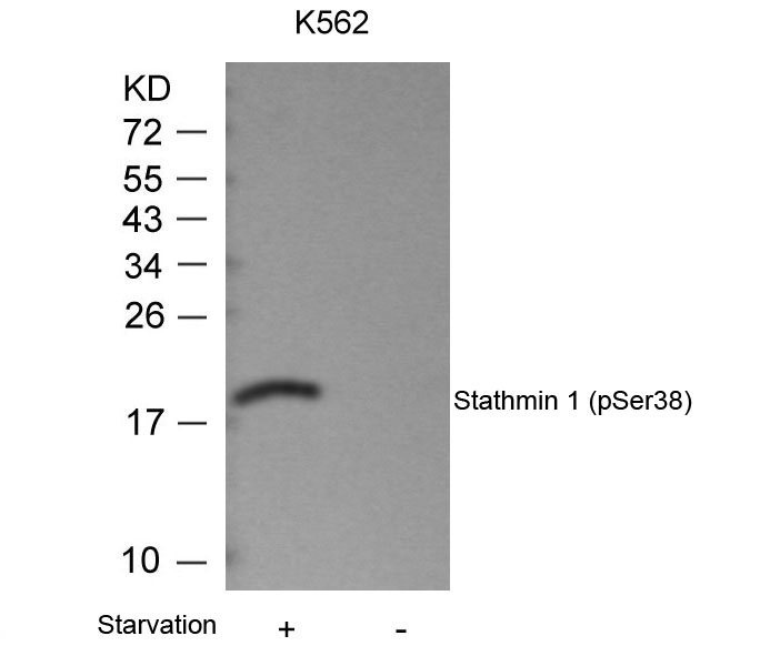 Polyclonal Antibody to Stathmin 1 (Phospho-Ser38)