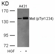 Polyclonal Antibody to Met (Phospho-Tyr1234)