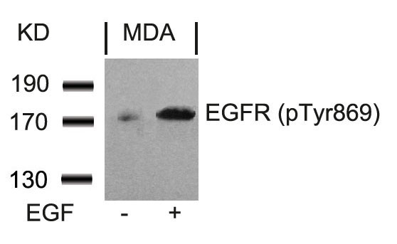 Polyclonal Antibody to EGFR (Phospho-Tyr869)