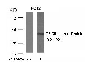 Polyclonal Antibody to S6 Ribosomal Protein (Phospho-Ser235)