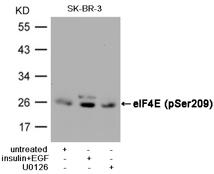 Polyclonal Antibody to eIF4E (Phospho-Ser209)