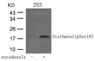 Polyclonal Antibody to Stathmin 1 (Phospho-Ser16)